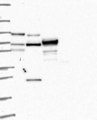 Western Blot: Kell Antibody [NBP3-17727]