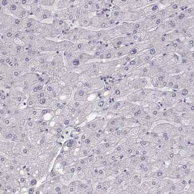 Immunohistochemistry-Paraffin: Keratin 31 Antibody [NBP2-46823]