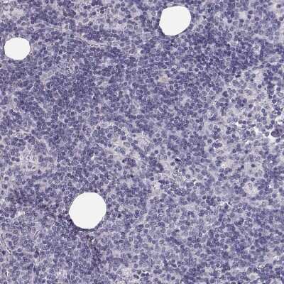 Immunohistochemistry-Paraffin: Keratin 31 Antibody [NBP2-46823]