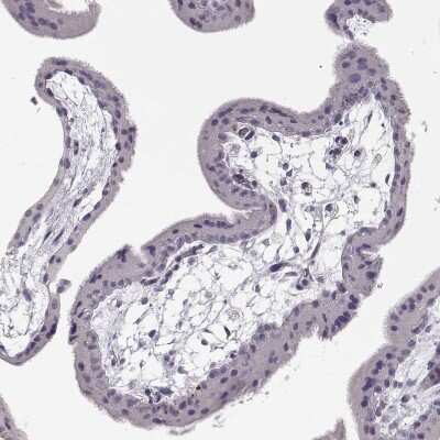 Immunohistochemistry-Paraffin: Keratin 31 Antibody [NBP2-46823]