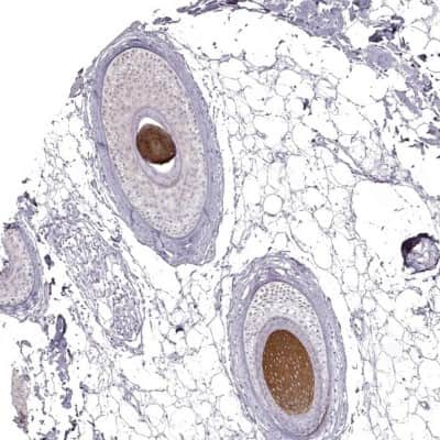 Immunohistochemistry-Paraffin: Keratin 31 Antibody [NBP2-46823]