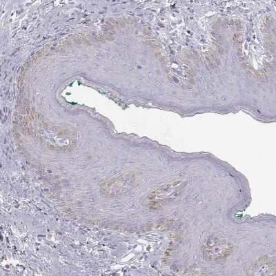 Immunohistochemistry-Paraffin: Keratin 31 Antibody [NBP2-46823]