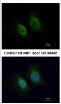 Immunocytochemistry/ Immunofluorescence: Keratin 36 Antibody [NBP2-17038]