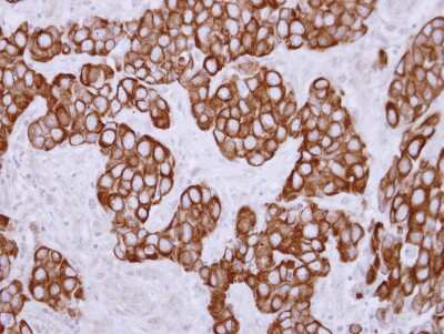 Immunohistochemistry-Paraffin: Keratin 36 Antibody [NBP2-17038]