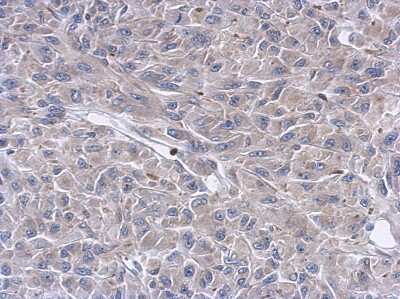 Immunohistochemistry-Paraffin: Keratin 36 Antibody [NBP2-17039]