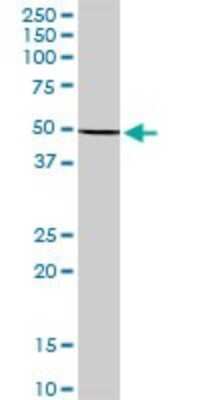 Western Blot: Keratin 36 Antibody [H00008689-B01P]