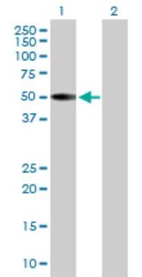 Western Blot: Keratin 36 Antibody [H00008689-B01P]