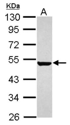 Western Blot: Keratin 36 Antibody [NBP2-17038]