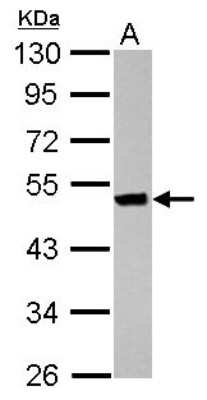 Western Blot: Keratin 36 Antibody [NBP2-17039]