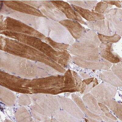 Immunohistochemistry: Keratin Associated Protein 20-3 Antibody [NBP2-30784]