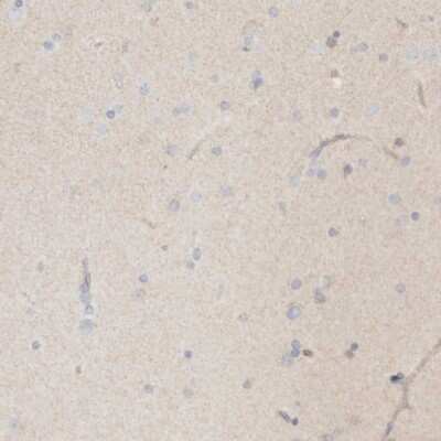 Immunohistochemistry-Paraffin: Keratinocyte Differentiation Factor 1 Antibody [NBP1-93838]