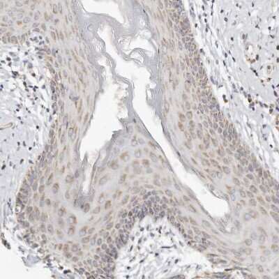 Immunohistochemistry-Paraffin: Keratinocyte Differentiation Factor 1 Antibody [NBP1-93838]