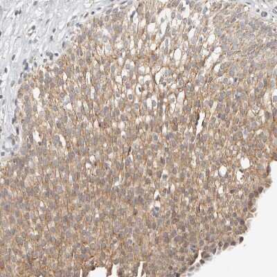 Immunohistochemistry-Paraffin: Keratinocyte Differentiation Factor 1 Antibody [NBP1-93838]