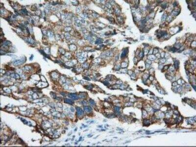 Immunohistochemistry-Paraffin: Ketohexokinase Antibody (OTI1D8) [NBP2-02639]
