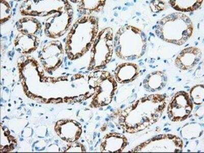 Immunohistochemistry-Paraffin: Ketohexokinase Antibody (OTI1D8) [NBP2-02639]