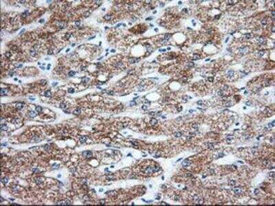 Immunohistochemistry-Paraffin: Ketohexokinase Antibody (OTI1D8) [NBP2-02639]