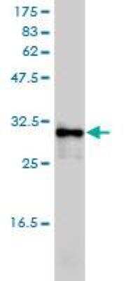 Western Blot: Ketohexokinase Antibody (1H6-2B6) [H00003795-M01]