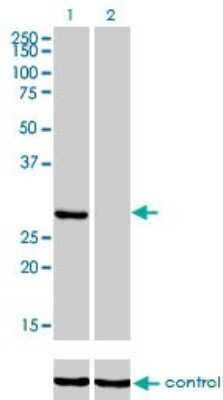 Western Blot: Ketohexokinase Antibody (1H6-2B6) [H00003795-M01]