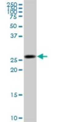 Western Blot: Ketohexokinase Antibody (1H6-2B6) [H00003795-M01]