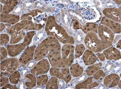 Immunohistochemistry-Paraffin: Ketohexokinase Antibody [NBP1-32778]