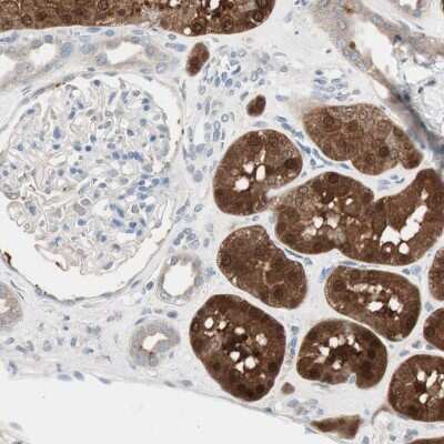 Immunohistochemistry-Paraffin: Ketohexokinase Antibody [NBP1-85790]