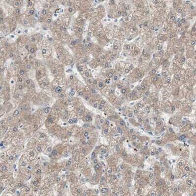 Immunohistochemistry-Paraffin: Ketohexokinase Antibody [NBP1-85790]