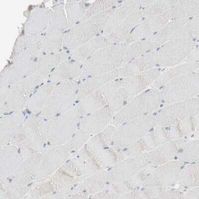 Immunohistochemistry-Paraffin: Ketohexokinase Antibody [NBP1-85790]