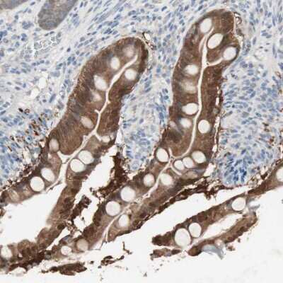 Immunohistochemistry-Paraffin: Ketohexokinase Antibody [NBP1-85790]