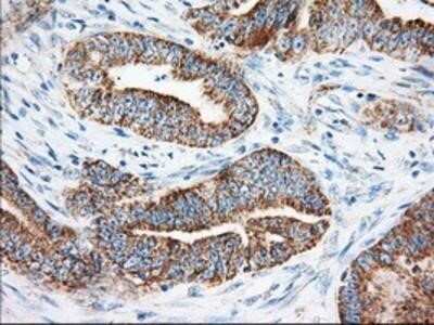 Immunohistochemistry: Ketohexokinase Antibody (OTI1D8) - Azide and BSA Free [NBP2-71069]