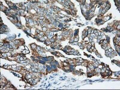 Immunohistochemistry: Ketohexokinase Antibody (OTI1D8) - Azide and BSA Free [NBP2-71069]