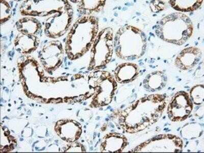 Immunohistochemistry: Ketohexokinase Antibody (OTI1D8) - Azide and BSA Free [NBP2-71069]