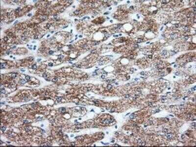 Immunohistochemistry: Ketohexokinase Antibody (OTI1D8) - Azide and BSA Free [NBP2-71069]