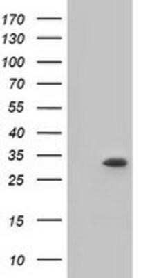 Western Blot: Ketohexokinase Antibody (OTI1D8)Azide and BSA Free [NBP2-71069]