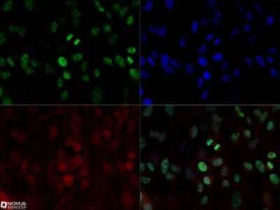 Immunocytochemistry/ Immunofluorescence: Ki67/MKI67 Antibody (8D5) - BSA Free [NBP2-22112]
