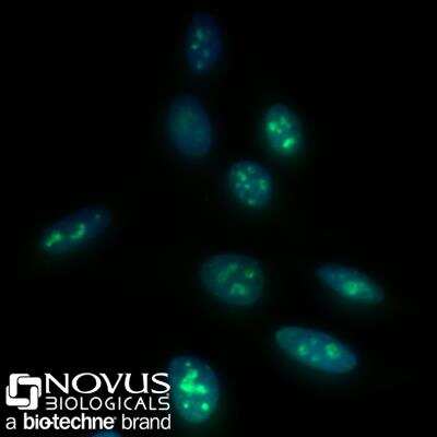 Immunocytochemistry/ Immunofluorescence: Ki67/MKI67 Antibody (8D5) - BSA Free [NBP2-22112]