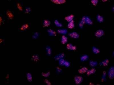 Immunocytochemistry/ Immunofluorescence: Ki67/MKI67 Antibody (8D5) - BSA Free [NBP2-22112]