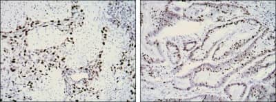 Immunohistochemistry-Paraffin: Ki67/MKI67 Antibody (8D5) - BSA Free [NBP2-22112]