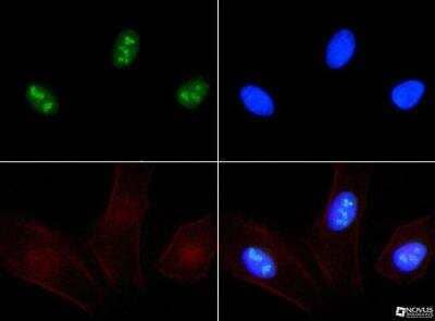 Immunocytochemistry/ Immunofluorescence: Ki67/MKI67 Antibody - BSA Free [NB500-170]