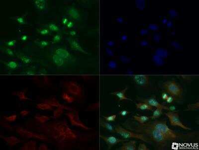Immunocytochemistry/ Immunofluorescence: Ki67/MKI67 Antibody [DyLight 594] [NB500-170DL594]
