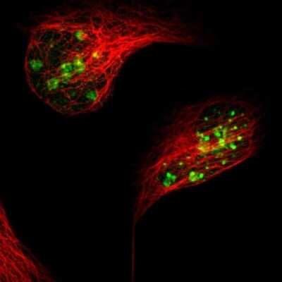 Immunocytochemistry/ Immunofluorescence: Ki67/MKI67 Antibody [NBP2-54657]
