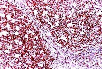 Immunohistochemistry-Paraffin: Ki67/MKI67 Antibody - BSA Free [NB500-170]