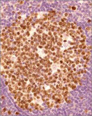 Immunohistochemistry-Paraffin: Ki67/MKI67 Antibody - BSA Free [NB500-170]