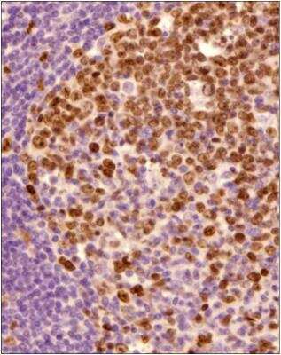 Immunohistochemistry-Paraffin: Ki67/MKI67 Antibody - BSA Free [NB500-170]