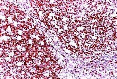 Immunohistochemistry-Paraffin: Ki67/MKI67 Antibody [DyLight 594] [NB500-170DL594]