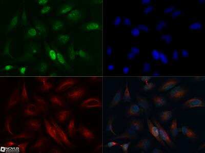 Immunocytochemistry/ Immunofluorescence: Ki67/MKI67 Antibody [NBP2-19012]