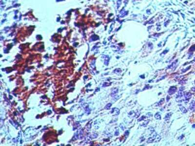 Immunohistochemistry-Paraffin: Ki67/MKI67 Antibody [NBP2-19012]