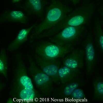 Immunocytochemistry/ Immunofluorescence: Ki67/MKI67 Antibody - BSA Free [NB110-89717]