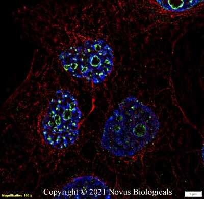 Immunocytochemistry/ Immunofluorescence: Ki67/MKI67 Antibody - BSA Free [NB110-89717]