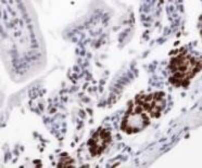 Immunohistochemistry: Ki67/MKI67 Antibody - BSA Free [NB110-89717]