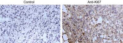 Immunohistochemistry-Paraffin: Ki67/MKI67 Antibody - BSA Free [NB110-89717]